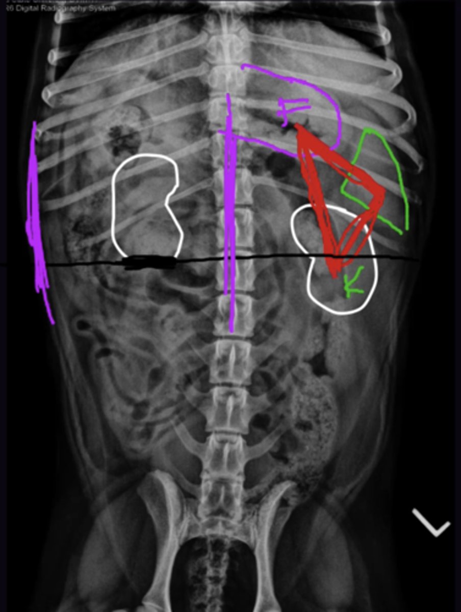 <p>1. Right Kidney more cranial, Caudal pole of Right kidney should be in line with middle of left kidney</p><p>2. Can only see caudal pole as cranial pole is effacing with liver </p><p>3. Not seen on VD in most dogs as cranial pole is effacing the liver (Seen on cats as kidney doesn"t efface) </p><p>4. Both seen on both views (More parallel + more mobile)</p>