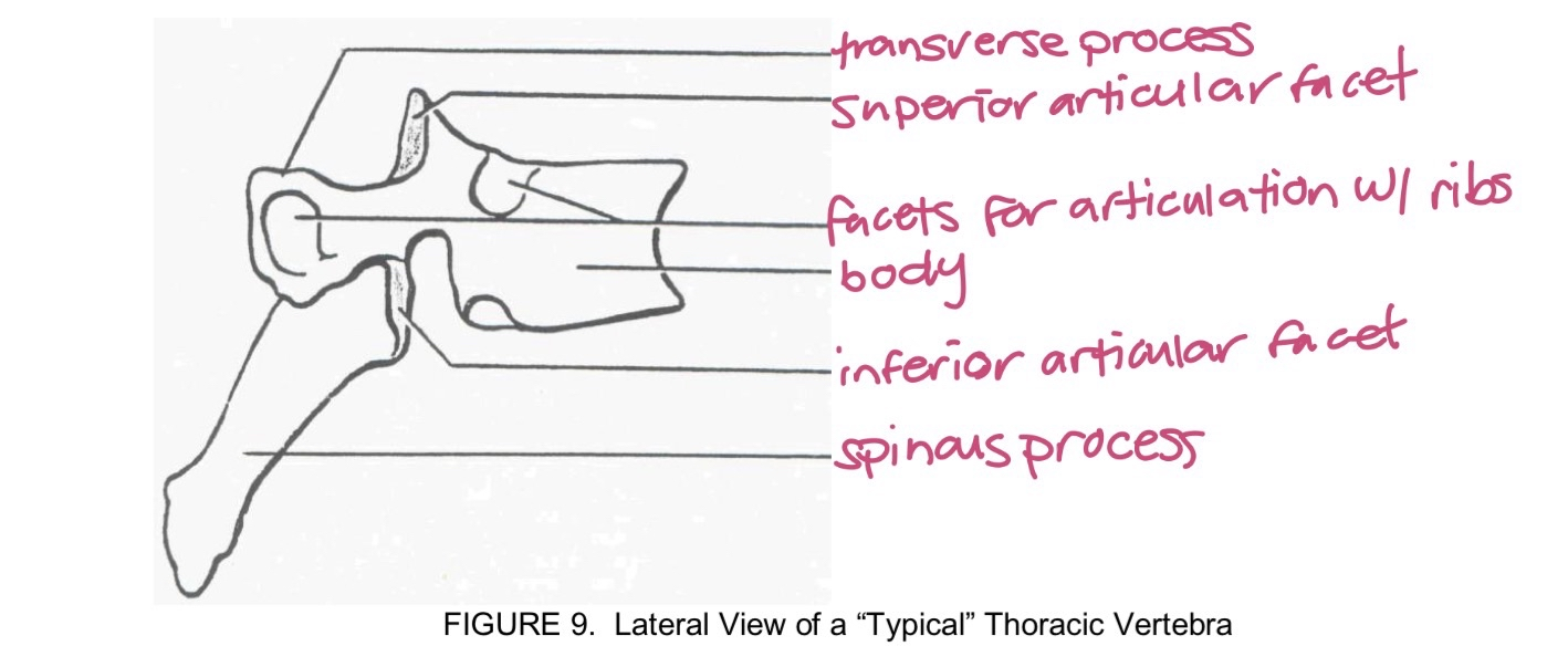 <p>T1-T12 thoracic vertebrae</p>