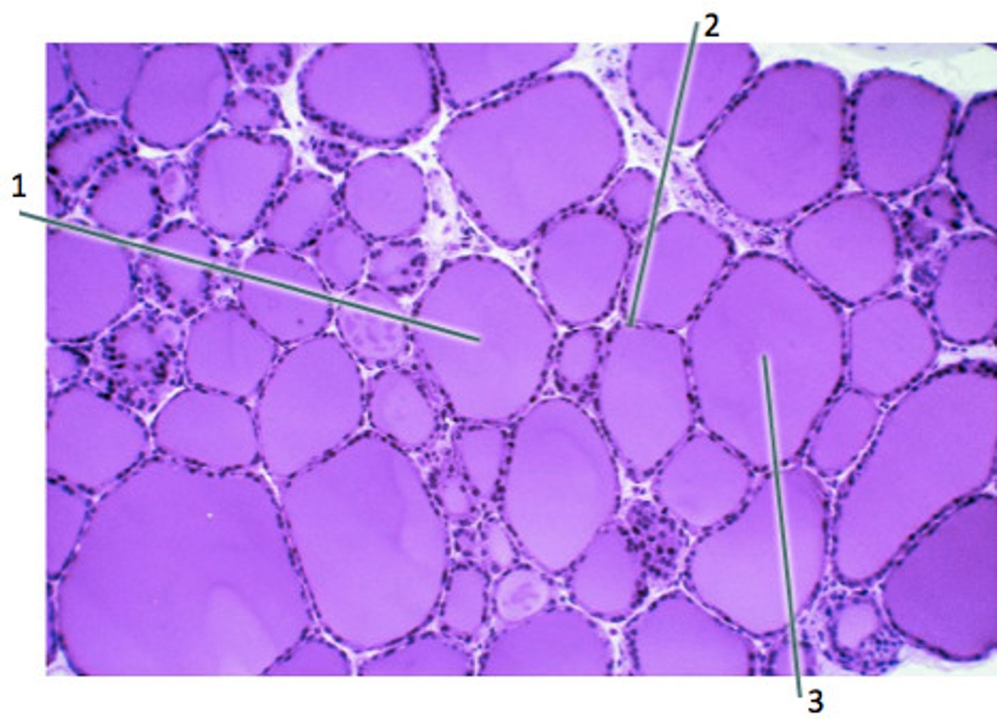 <p>Identify labelded areas and hormones produced there</p><p>1. whole structure</p><p>2.</p><p>3. Fluid inside</p>