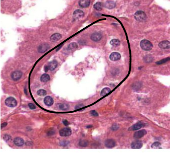 <p>Simple:</p><p>• One layer of cells is present</p><p>Cuboidal:</p><p>• Apical surface cells are cube shaped in cross section</p><p>• As wide as they are tall</p><p>• Round nuclei</p>