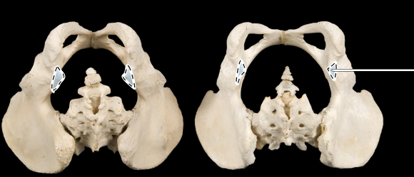 <p>Articulated male (at left) and female (at right) pelves, inferior view</p>