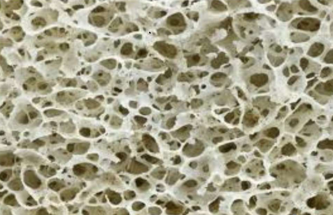 <p>C’est une membrane conjonctive fibreuse qui recouvre l’os. Permet l’ancrage des tendons et des ligaments et permet la croissance et la réparation de l’os</p>