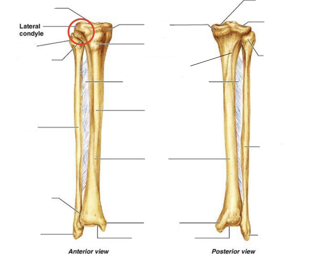 <p><span><span>Lateral condyle on the tibia</span></span></p>