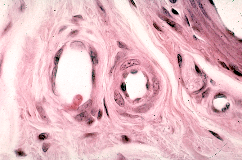 <p>Identify the arteriole, venule and capillary.</p>