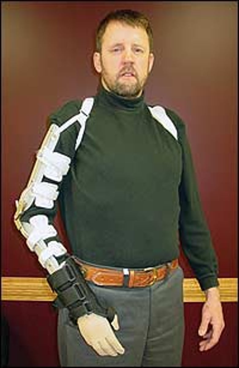 <p>to hurt one's arm</p>