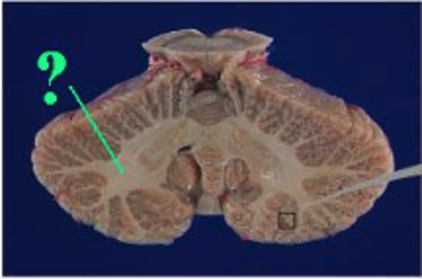 <p>white matter</p>