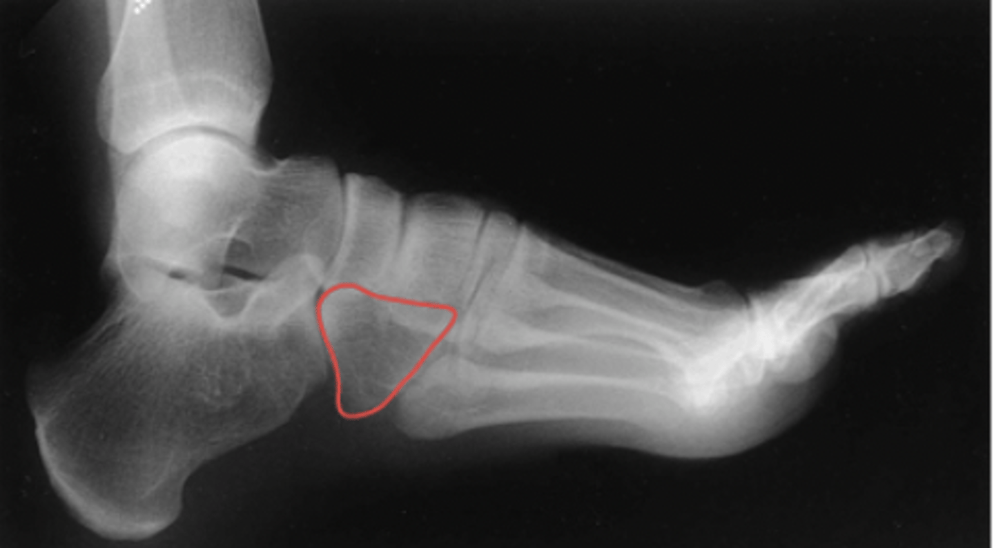 <p>What structure is highlighted?</p>