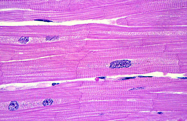 <p><strong>What is a picture example of cardiac muscle tissue? </strong></p>