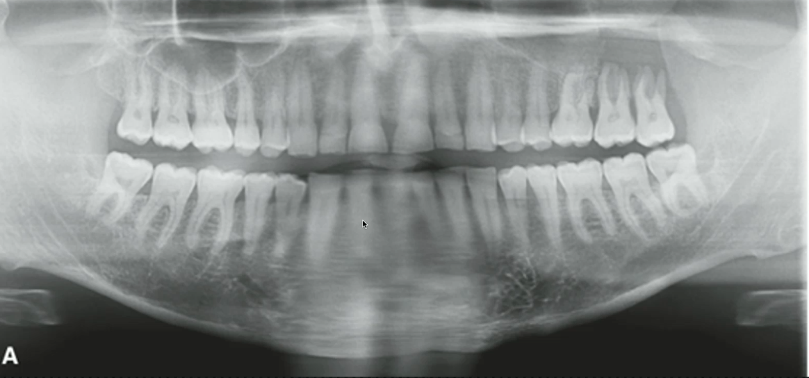 <p>where is the lesion?</p>