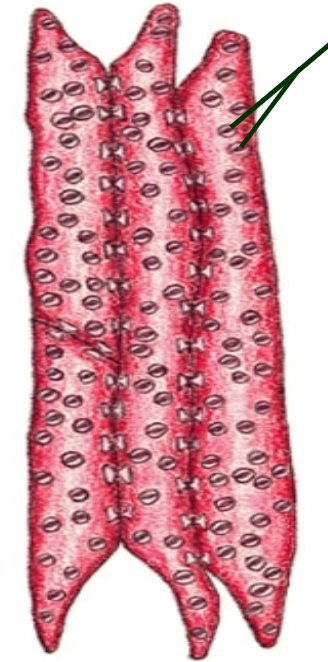 <p>tapered cells, not open at the end.  often have pits in between them</p>