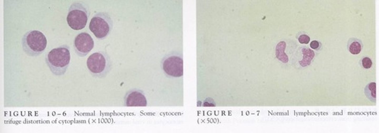 <p>-major clinical significance: normal/ viral, tubercular, and fungal meningitis/ multiple sclerosis</p><p>-microscopic findings: found mixed with lymphocytes</p>