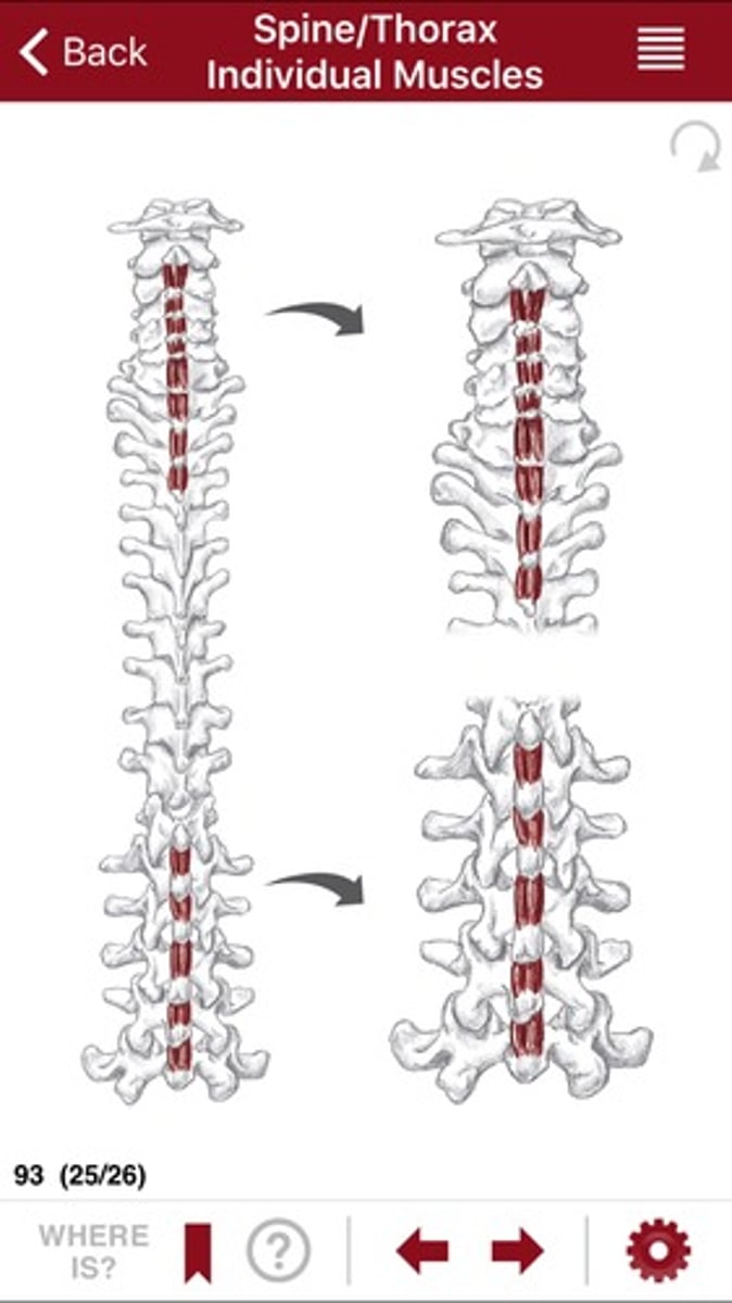 <p>spinous process of cervical and lumbar vertebrae</p>