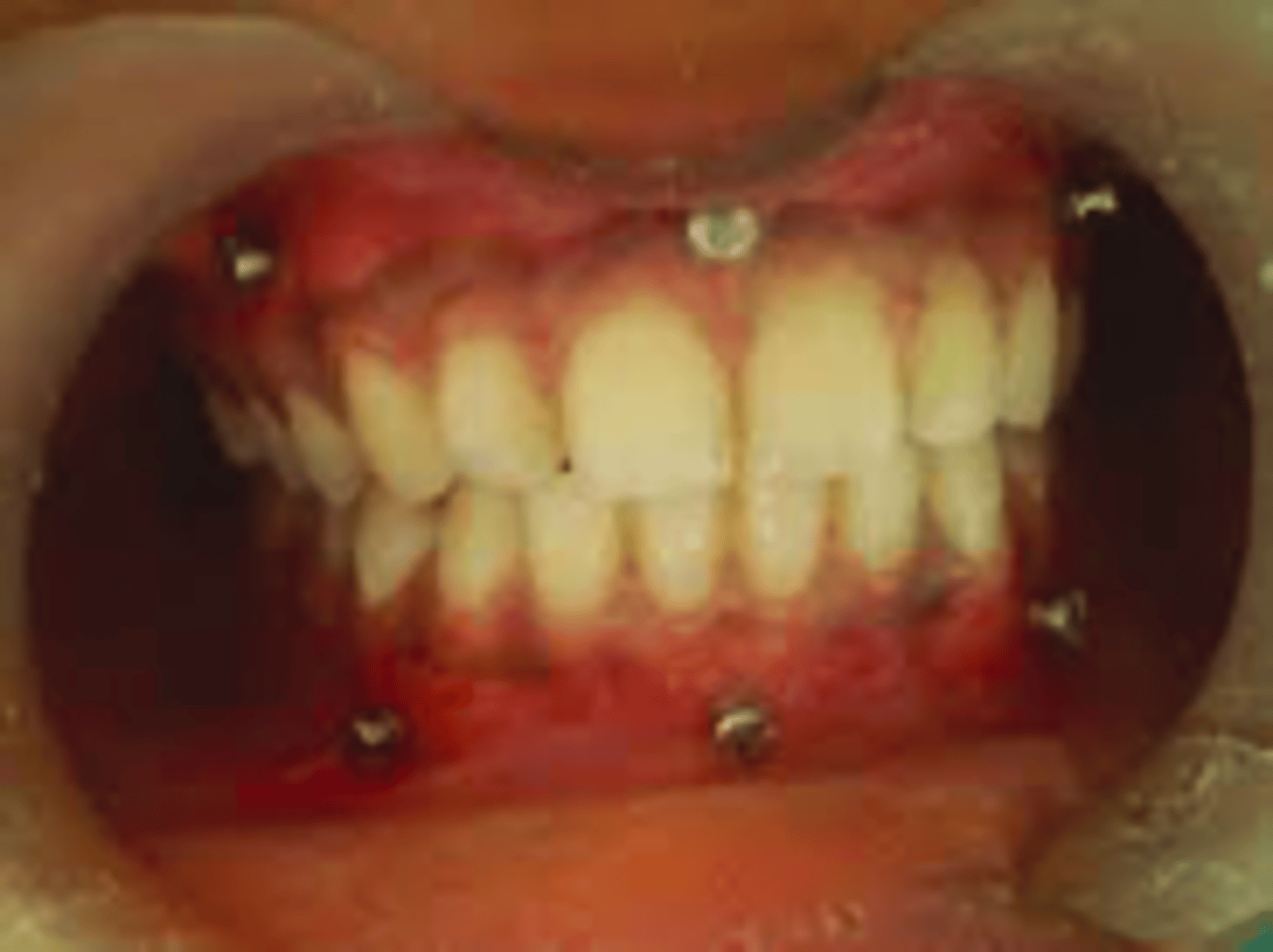 <p>ID the MMF device:</p>