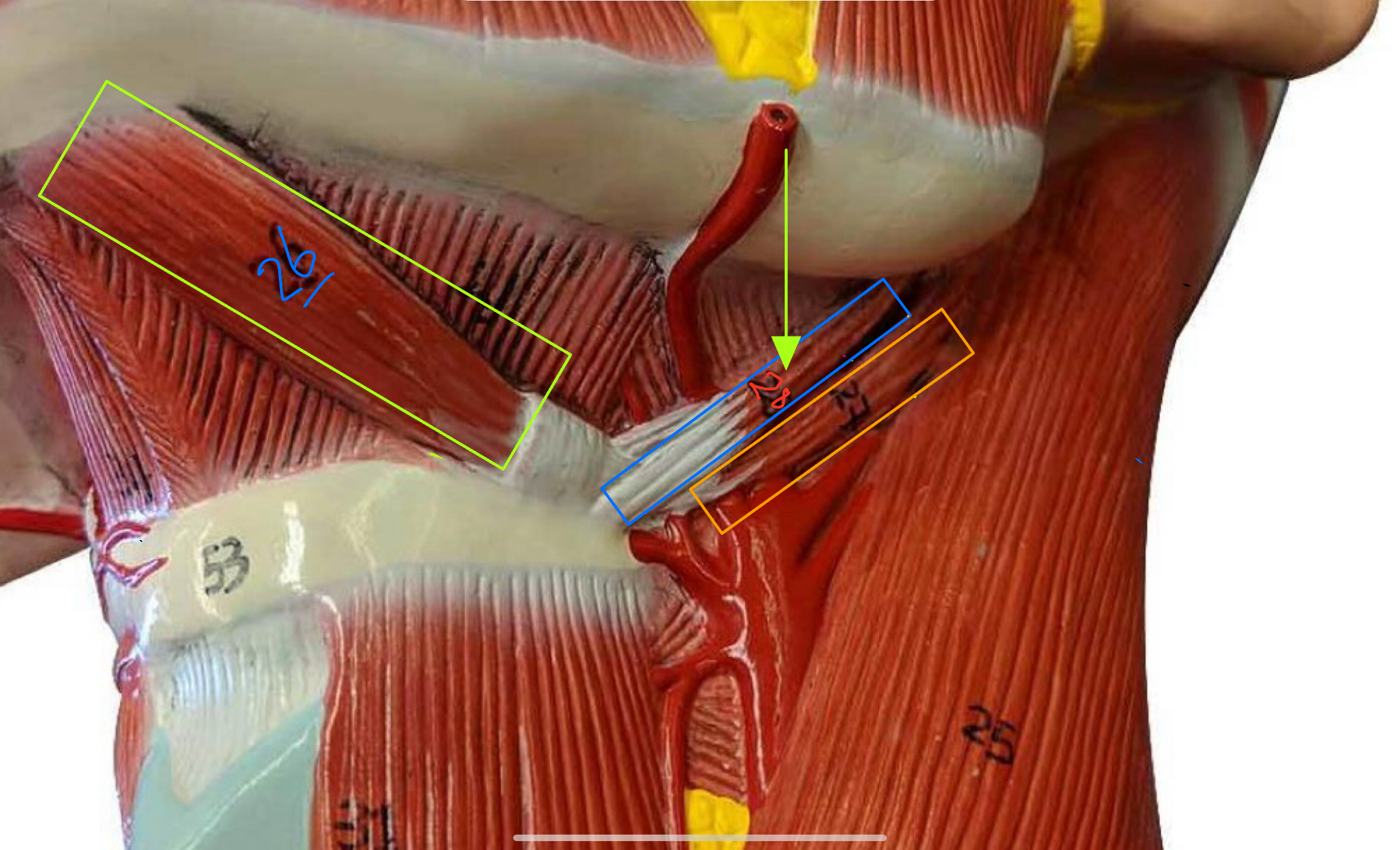 <p>What type of muscle is this( altay model)</p>
