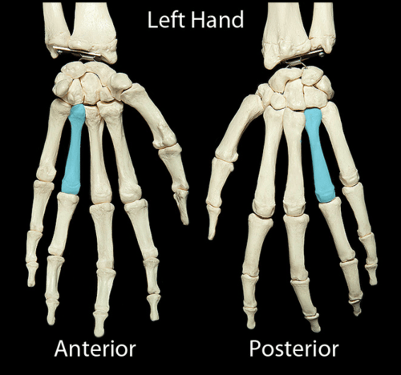 <p>What number is this metacarpal</p>