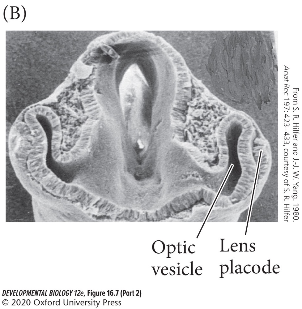 B) **Optic vesicles**