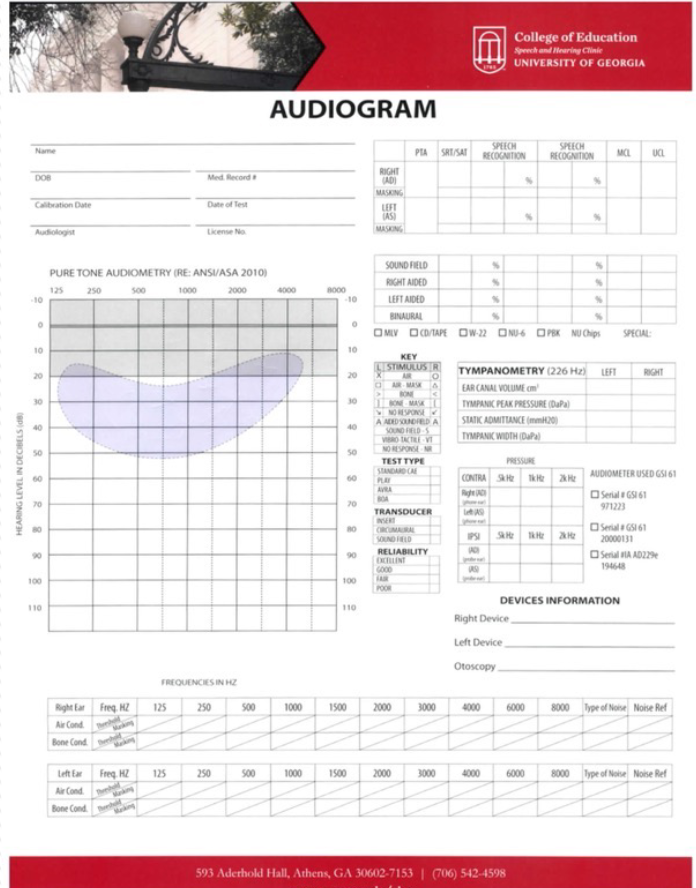 <p>Audiogram</p>
