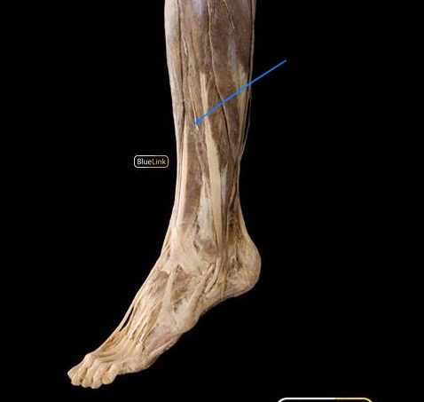 <p>terminal branch of the common fibuilar nerve, descends in the lateral compartment of the leg with the tibial artery</p><p></p><p>innervates: fibularis (peroneus) longus & fibularis (peroneus) brevis</p>