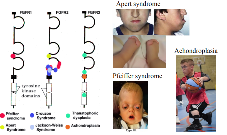<ul><li><p>Pfeiffer syndrome - Craniosynostosis (premature skull fusion) and distinct facial features (e.g., wide-set eyes).</p></li><li><p>Achondroplasia - Disproportionate short stature with short limbs, normal trunk, large head, and prominent forehead.</p></li></ul><p></p>