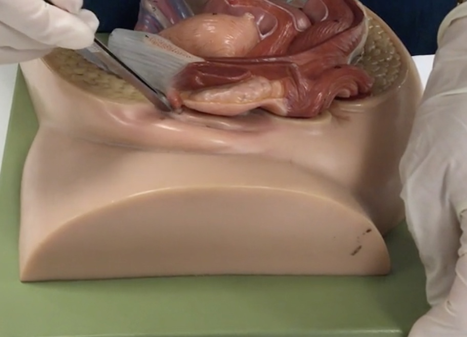 <p>Description: Thin, hairless folds medial to labium majus</p><p>Relationship: Contains sebaceous glands</p>