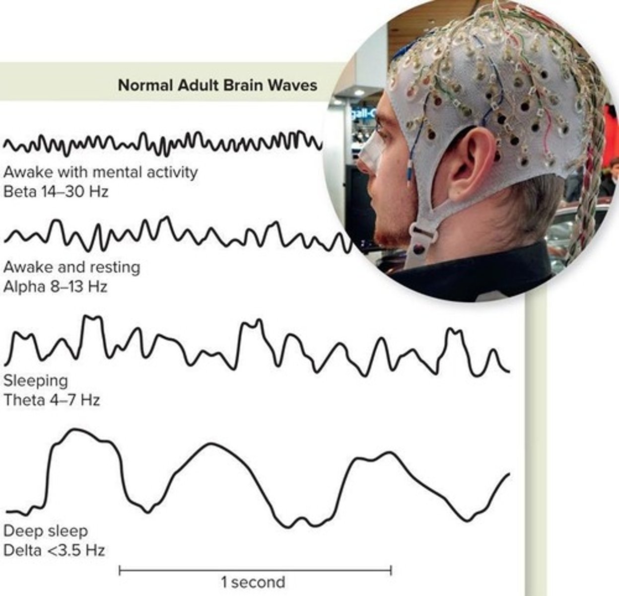 <p>It records electrical activity of the brain.</p>