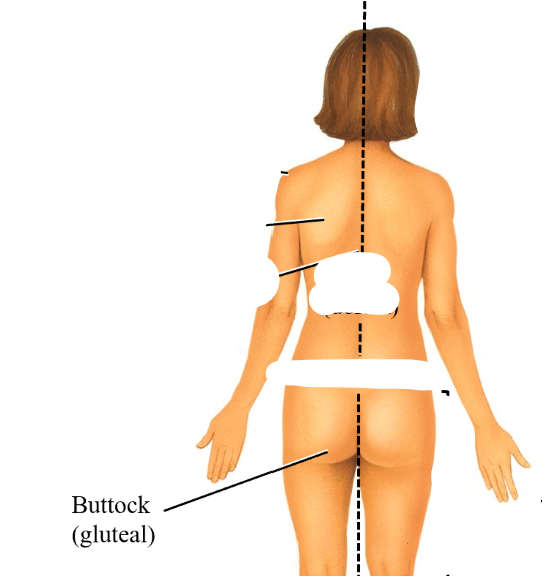 <p>gluteal</p>