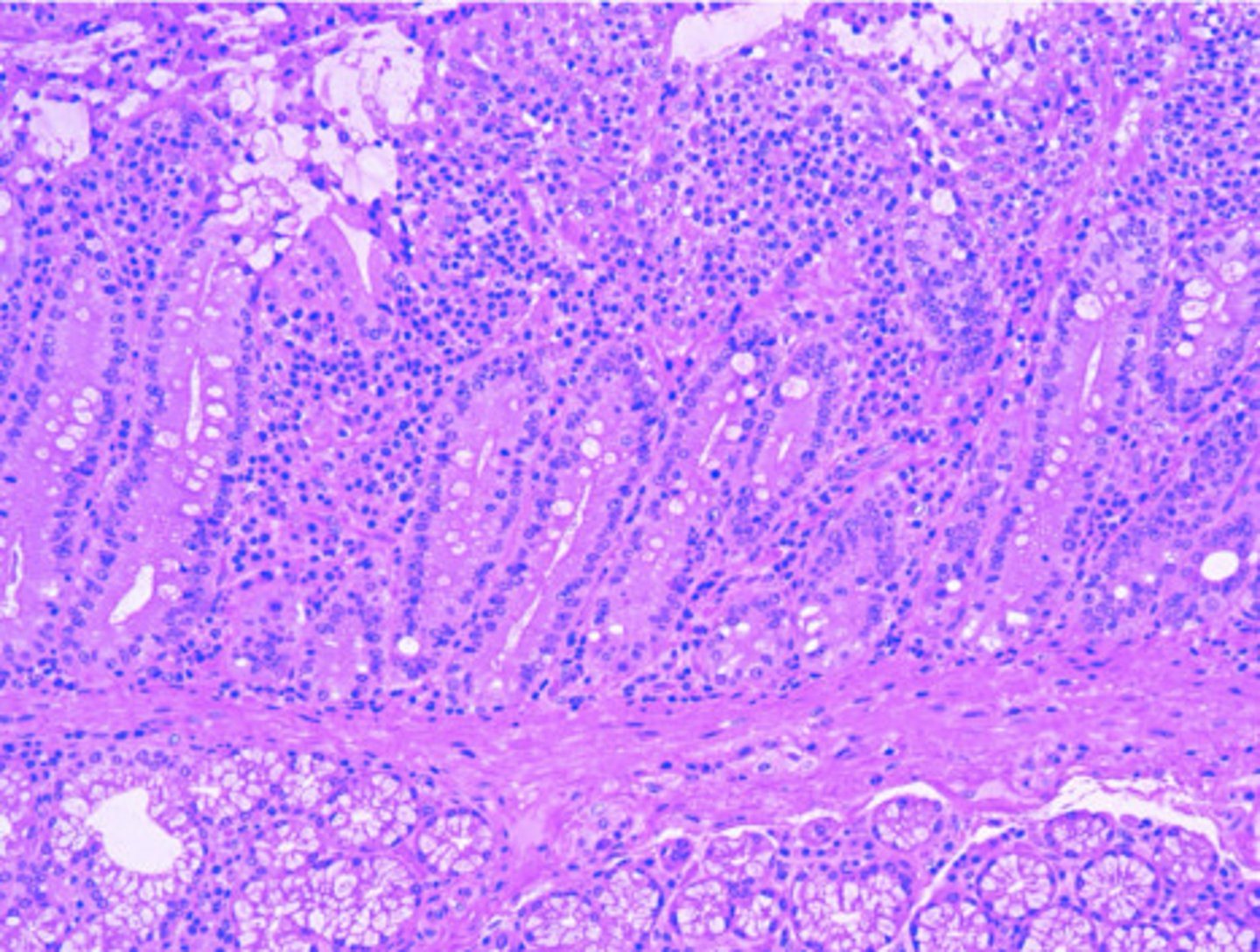 <p>ID the Histology</p>