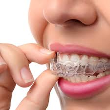 <p>Passive</p><p>Removable</p><p>Invisalign</p>