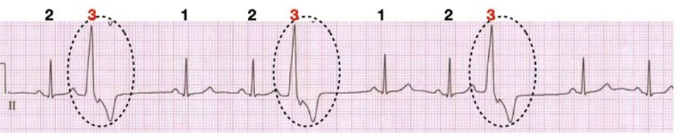 <p>What rhythm is this?</p>