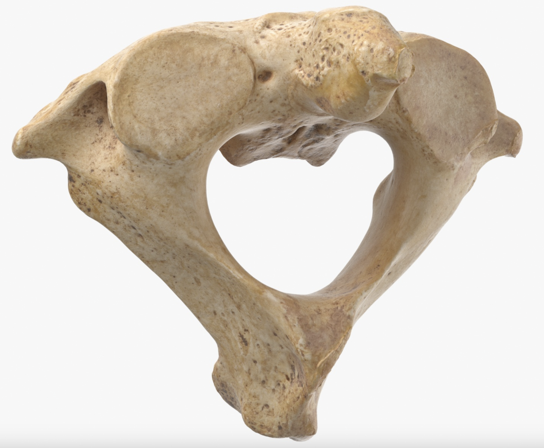 <p>What vertebra is this?</p>