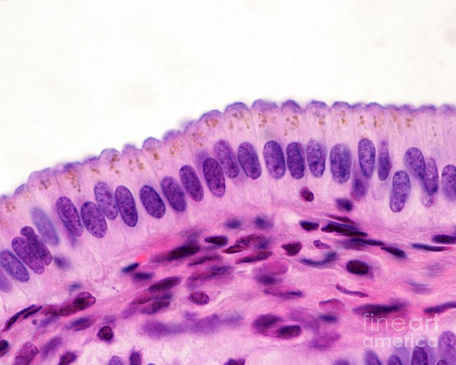 <p>nonciliated simple columnar ET </p>