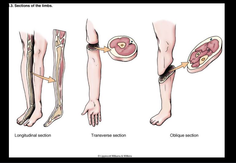 <p>oblique, transverse, longitudinal </p>