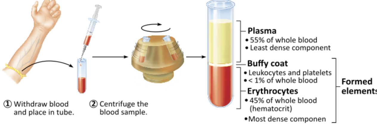 <p><span><span>Which of these makes up the greatest portion of whole blood by volume?</span></span></p><ol><li><p>platelets</p></li><li><p>leukocytes</p></li><li><p>plasma</p></li><li><p>erythrocytes</p></li></ol><p></p>