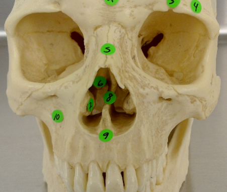 <p>#6 (anterior skull)</p>