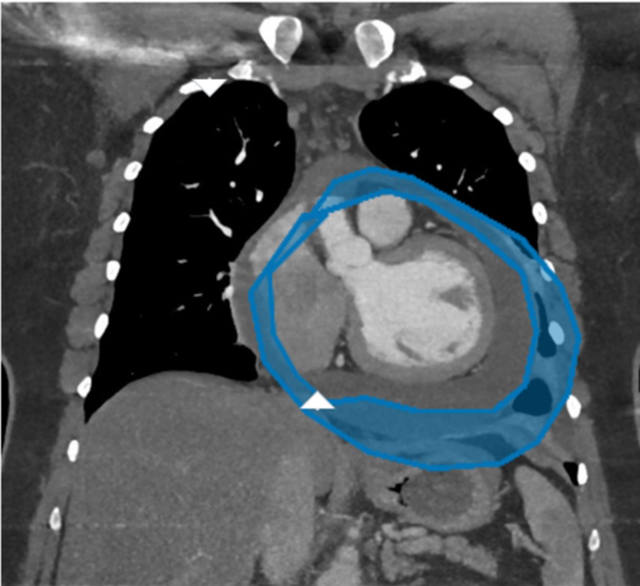 <p>Label pathology in image below</p>