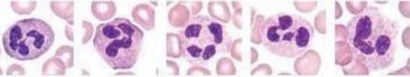 <p>What lymphocyte?</p>