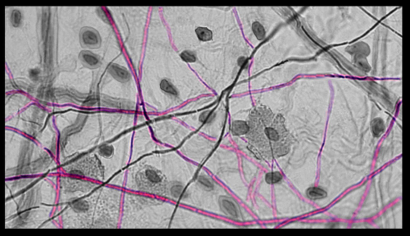 <p>no alignment</p><p>interwoven network</p>