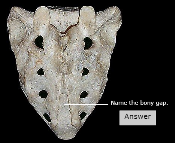 <p>(Just name the bone, not that specific gap)</p>