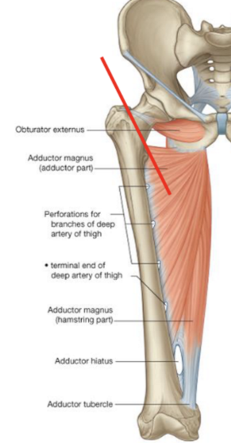 <p>adductor magnus (adductor component) </p>