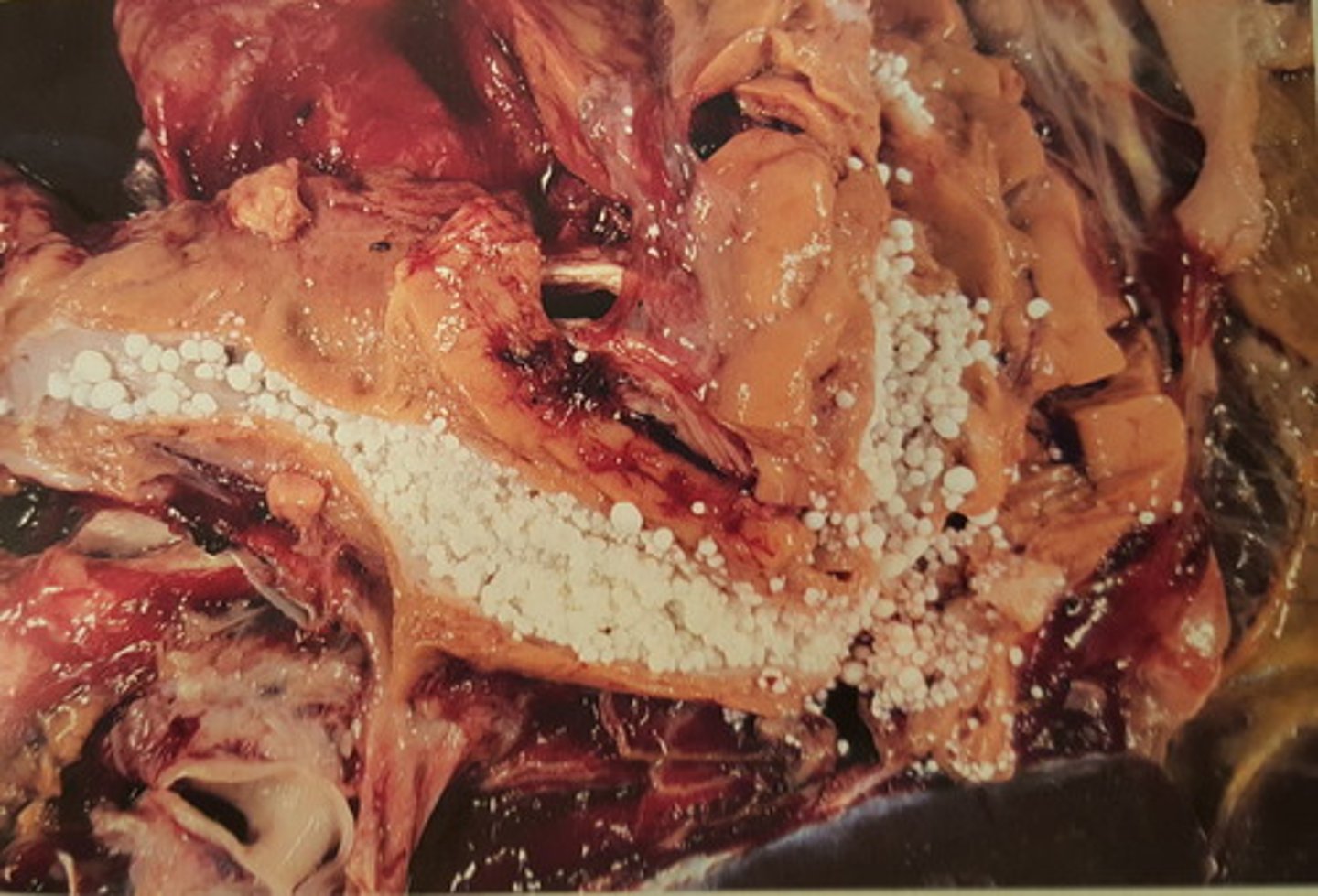 <p>Pancreas fra okse. Patoanatomisk diagnose?</p>