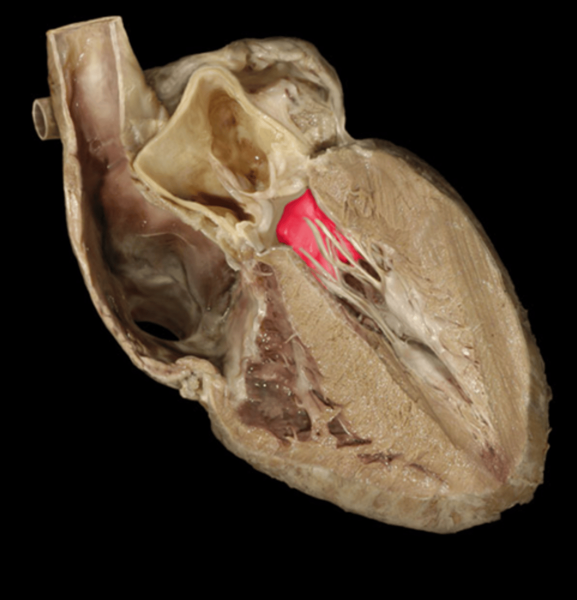 <p>AKA: left atrioventricular valve</p>