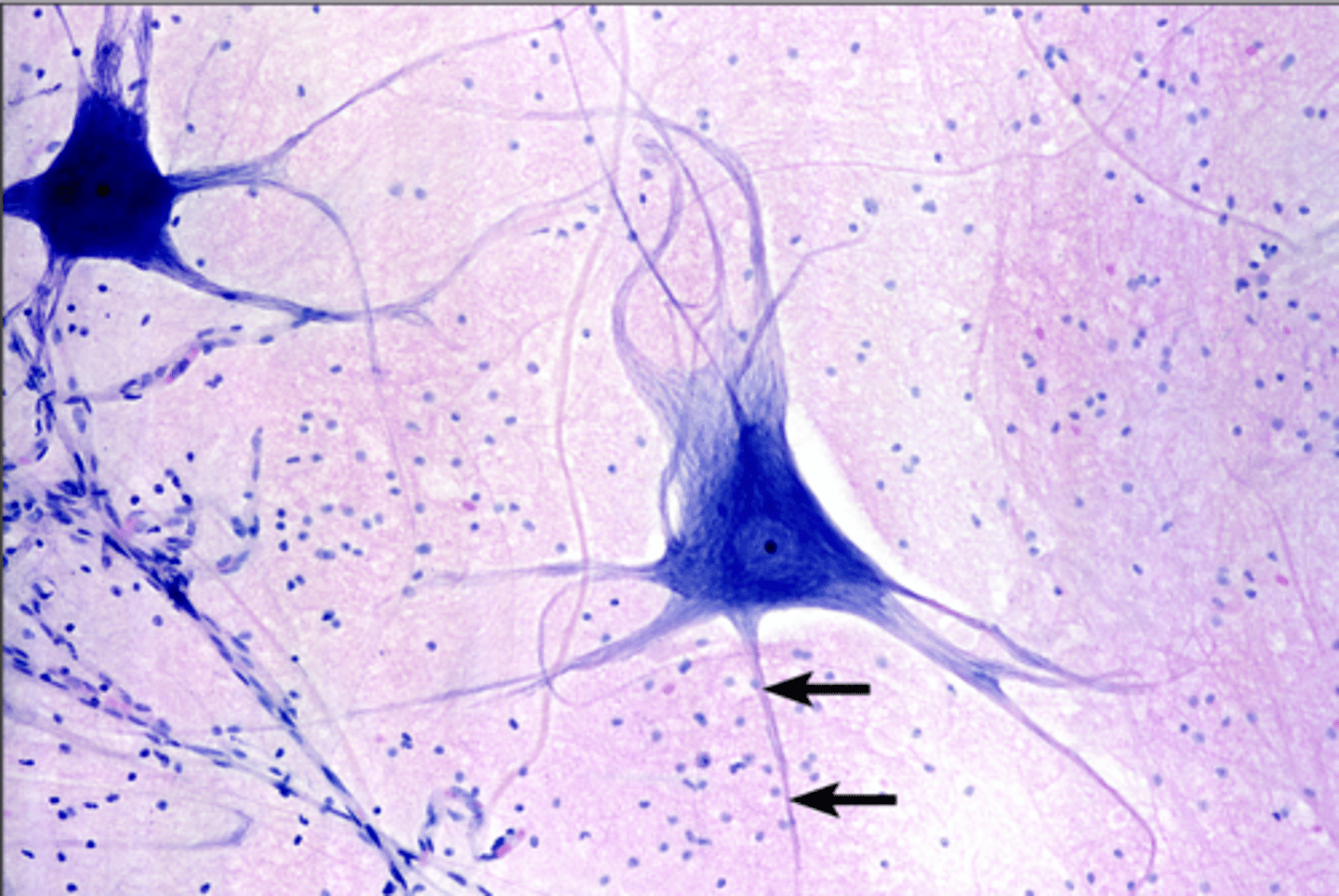 <p>singular long extension of nerve fiber</p>