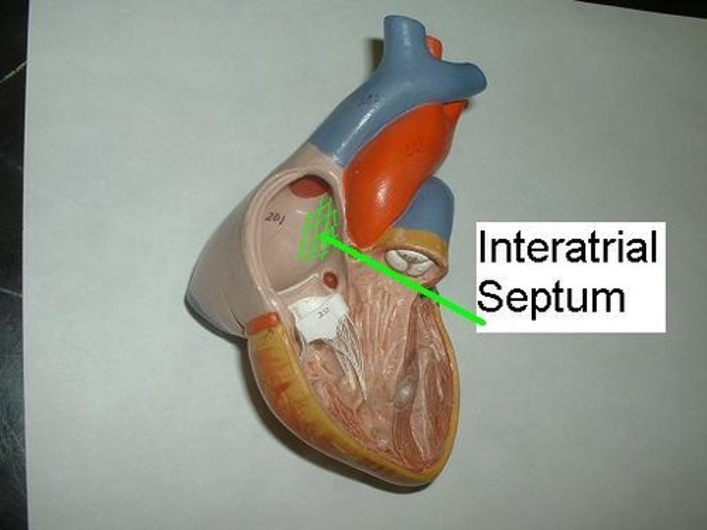 <p>Partition between right and left atria.</p>