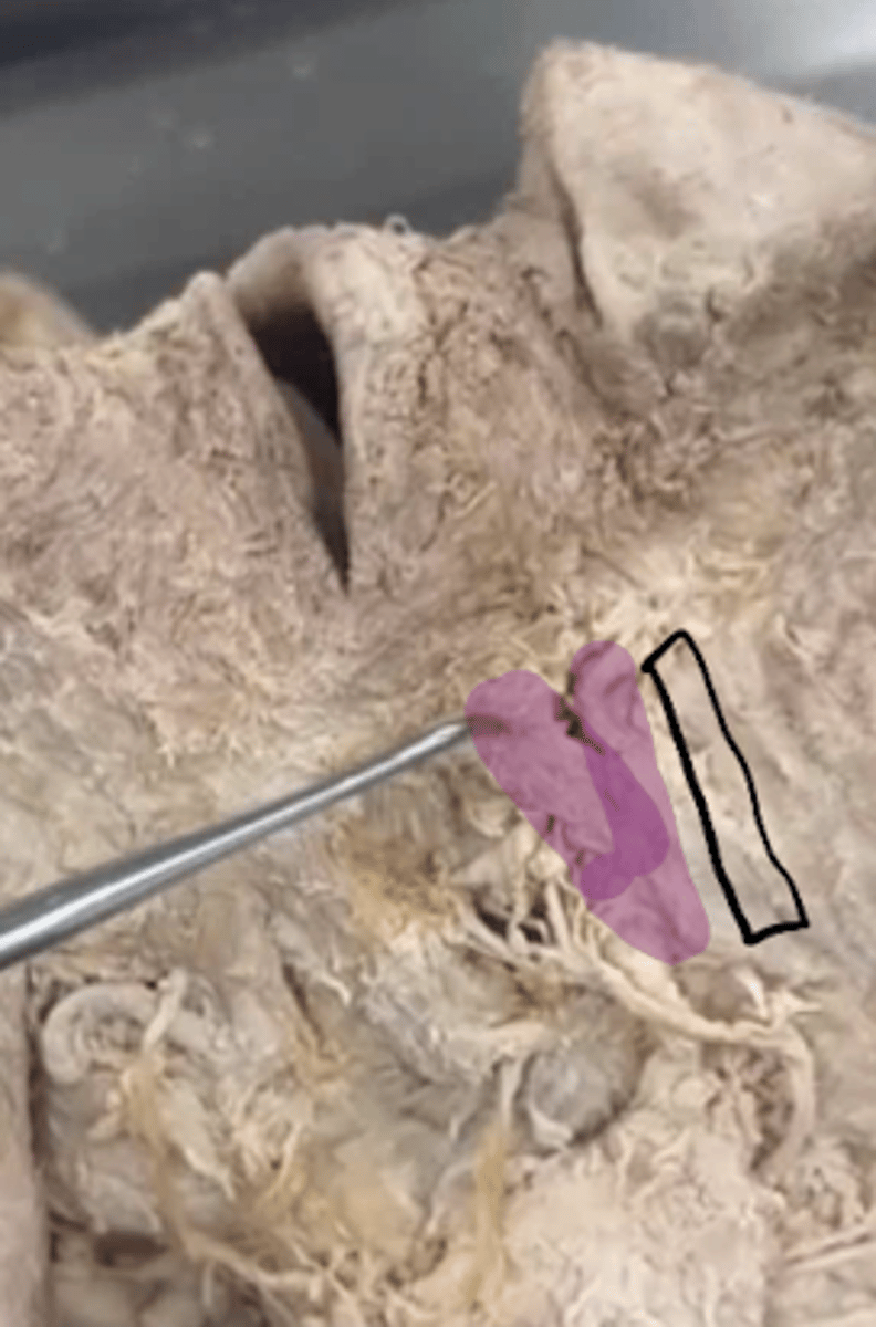 <p>Name the muscle.</p>