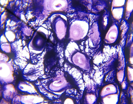 <p>what kind of cartilage is this</p>