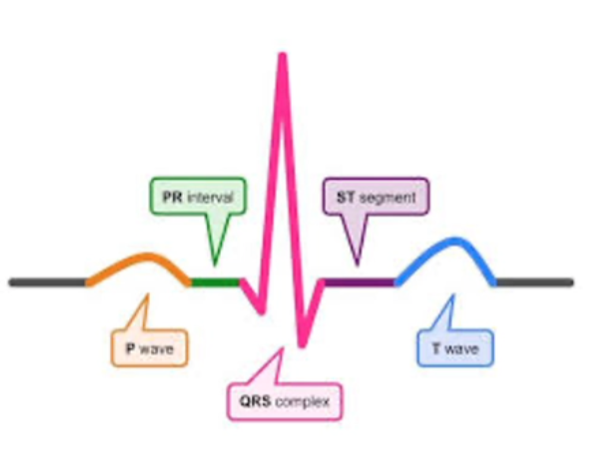 <p>pink: largest wave, ventricles contract</p>