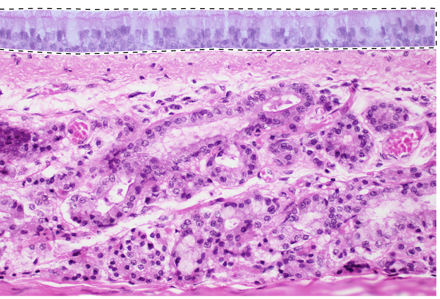 <p>Name the highlighted tissue.</p>
