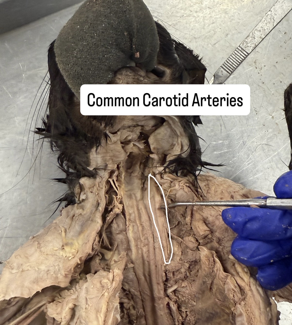 <p>common carotid arteries</p>