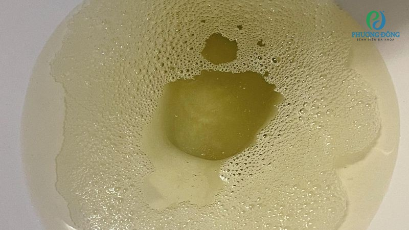 <p>urine</p>