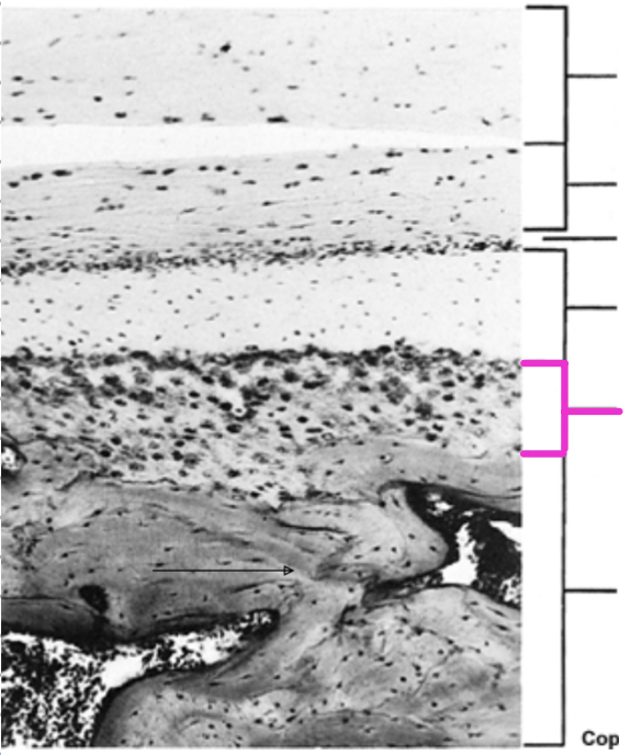 <p>Identify the histological structure of the adult mandibular condyle</p>